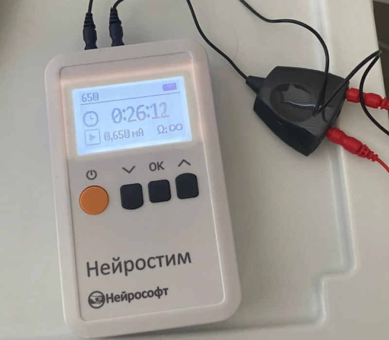 Стимуляция блуждающего нерва при нарушениях сна