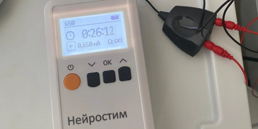 Стимуляция блуждающего нерва при нарушениях сна